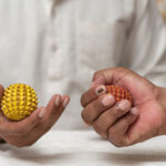 Varicose veins की बढ़ती समस्या Acupressure -Colour Therapy में इलाज